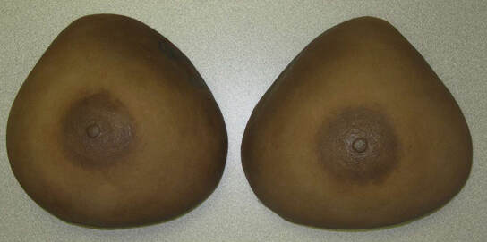 Custom Breast Prosthesis Durham North Carolina